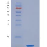 人S100钙结合蛋白A8(S100A8)重组蛋白