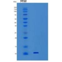 人硒蛋白W1(SEPW1)重组蛋白