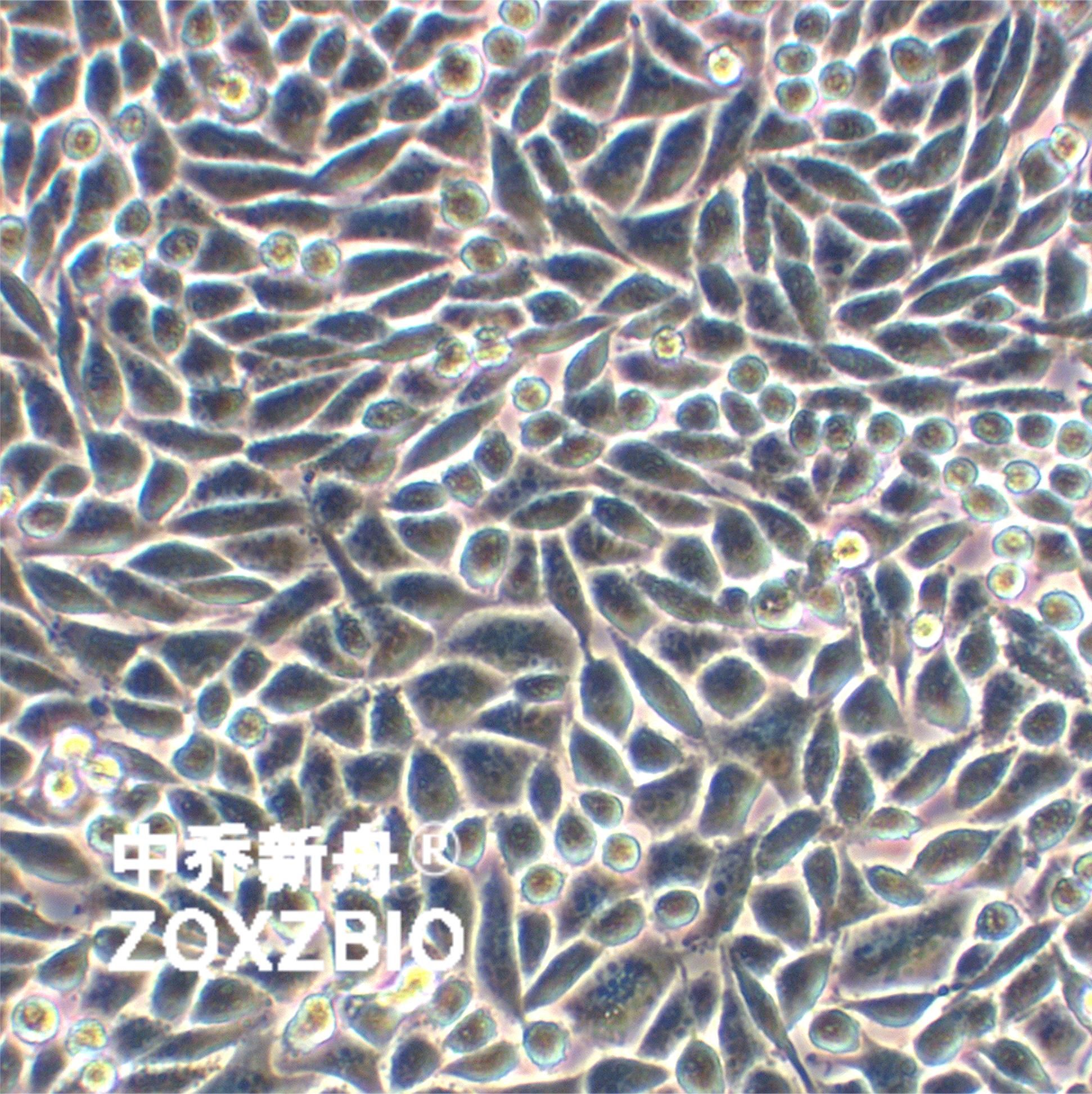 Lwnt-3a小鼠皮下结缔组织细胞