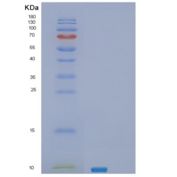 人SEC61B重组蛋白