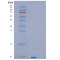 人SEC61B重组蛋白