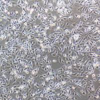 hct15 人结肠癌细胞/STR鉴定/镜像绮点(Cellverse)