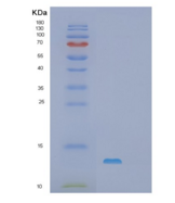 小鼠S100钙结合蛋白A1(S100A1)重组蛋白