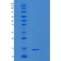 小鼠S100钙结合蛋白A4(S100A4)重组蛋白