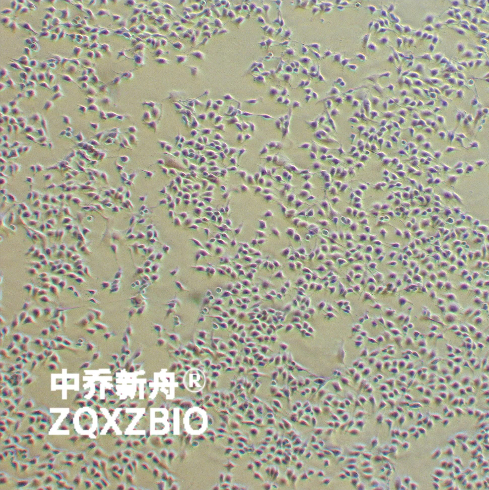 B16-F10小鼠黑色素瘤高转细胞