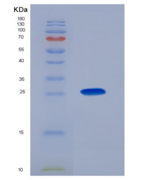人精氨酸/丝氨酸丰富剪接因子1(SRSF1)重组蛋白