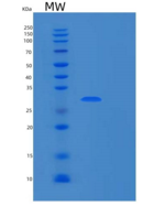 人RPP30重组蛋白