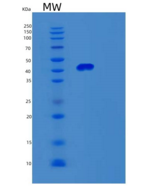 小鼠Serpine2重组蛋白