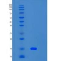 小鼠S100钙结合蛋白A15(S100A15)重组蛋白