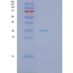 人分泌型卷曲相关蛋白5(SFRP5)重组蛋白