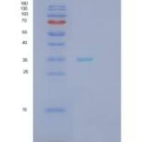 人分泌型卷曲相关蛋白5(SFRP5)重组蛋白