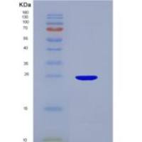 人分泌粒蛋白Ⅴ(SCG5)重组蛋白