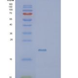 人SCP2D1重组蛋白