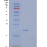 人SCP2D1重组蛋白