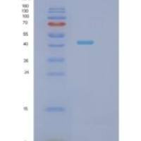 人SH3GLB2重组蛋白