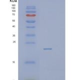 人囊泡运输蛋白SEC22b (SEC22B)重组蛋白