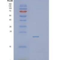 人囊泡运输蛋白SEC22b (SEC22B)重组蛋白