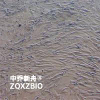 Hs888Lu人肺成纤维细胞