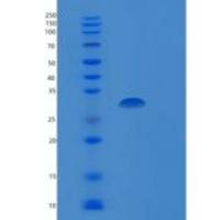人SDR16C5重组蛋白