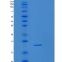 人核糖体蛋白S20(RPS20)重组蛋白