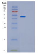 人鳞状细胞癌抗原1(SERPINB3)重组蛋白