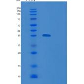 人cc R4-非转录复合物亚单位9（rqcd 1）重组蛋白