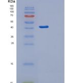 人蛋白C抑制因子(PCI)重组蛋白
