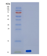 人丝氨酸/苏氨酸蛋白激酶受体R3重组蛋白
