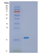 人剪接因子3B亚基14(SF3B14)重组蛋白