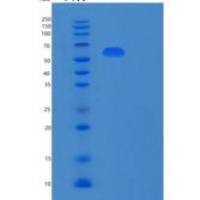 人核糖体结合糖蛋白Ⅱ(RPN2)重组蛋白