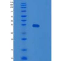 人SDCBP2重组蛋白