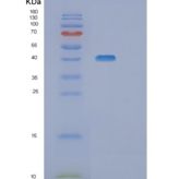人血清/糖皮质激素调节激酶1(SGK1)重组蛋白