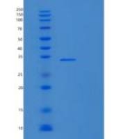 人核糖体蛋白S2(RPS2)重组蛋白
