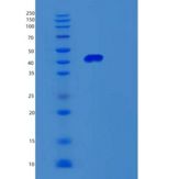 小鼠Serpine2重组蛋白