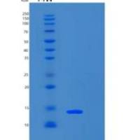 人S100钙结合蛋白A4(S100A4)重组蛋白