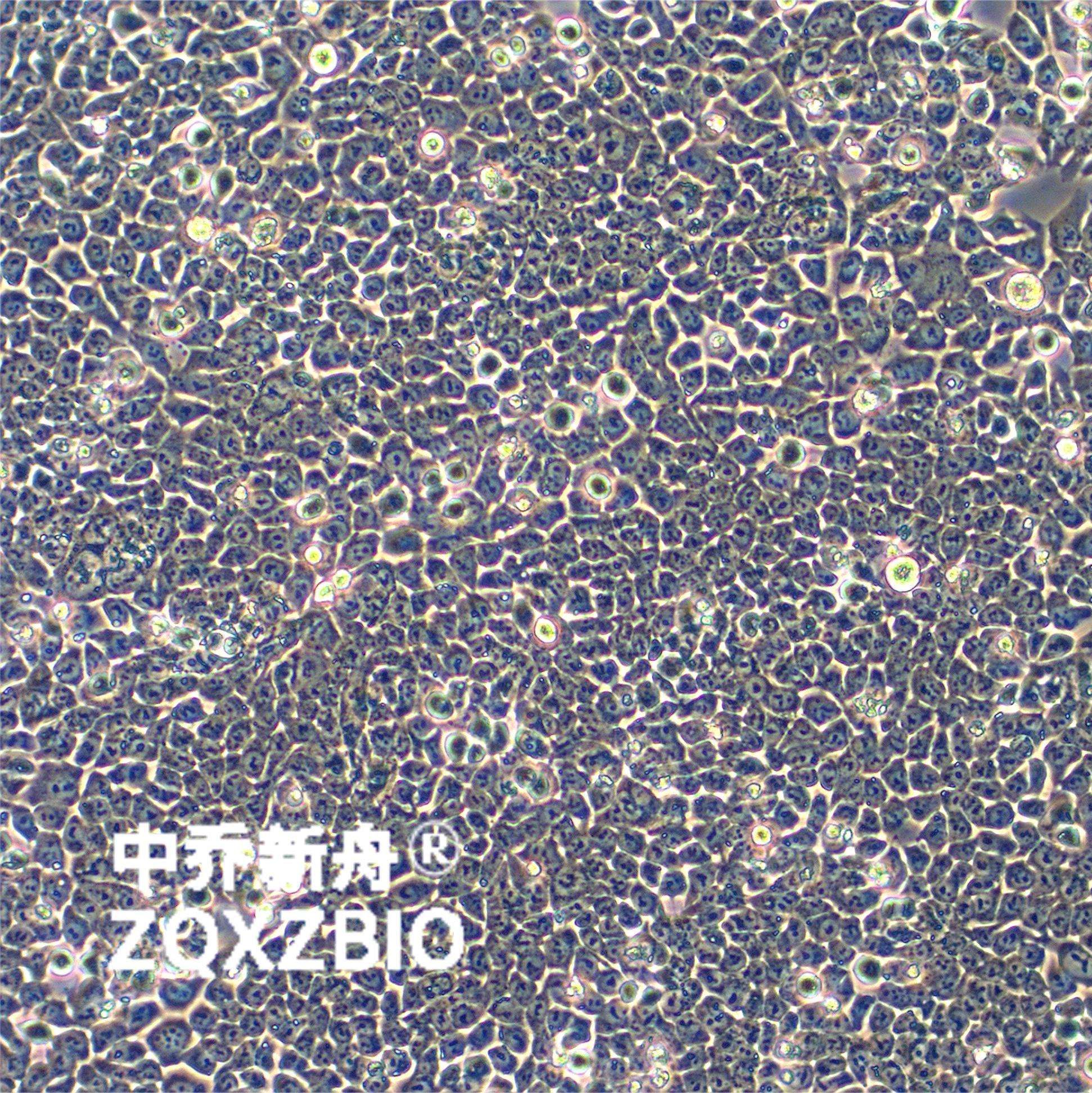 HCT-116人结肠癌细胞
