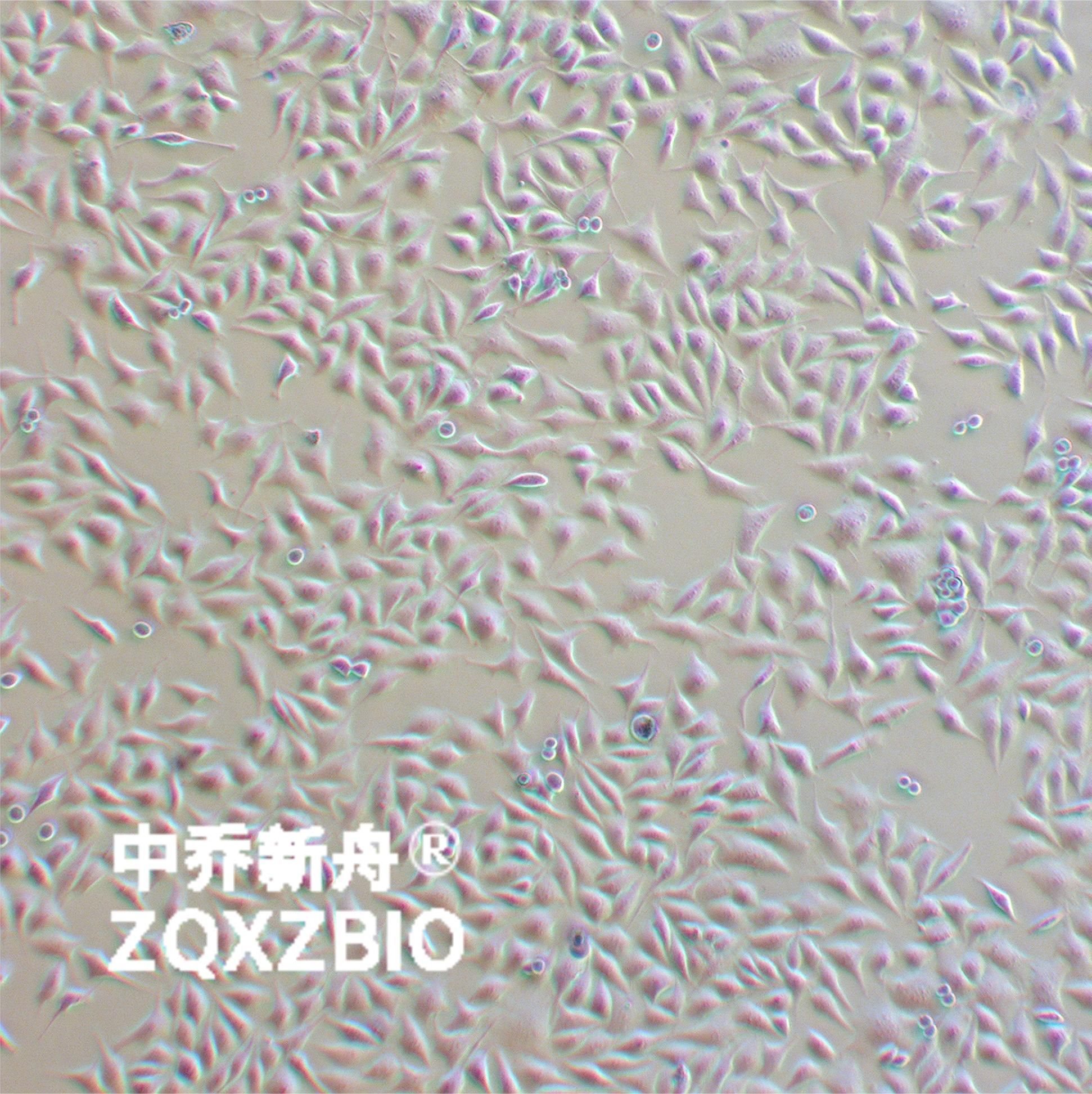 PC-3M人前列腺癌细胞
