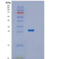 人SERTAD1重组蛋白