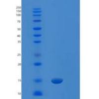 人琥珀酸脱氢酶装配因子1，线粒体(SDHAF1)重组蛋白
