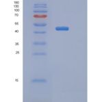 小鼠丝氨酸蛋白酶抑制剂A9(SERPINA9)重组蛋白