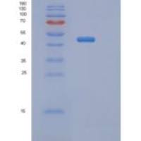 小鼠丝氨酸蛋白酶抑制剂A9(SERPINA9)重组蛋白