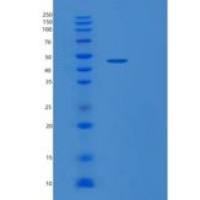 人核苷酸还原酶M2(RRM2)重组蛋白
