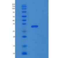 人RPS4X重组蛋白