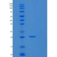 人含SCAN域蛋白1(SCAND1)重组蛋白