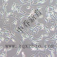 A172人胶质母细胞瘤细胞