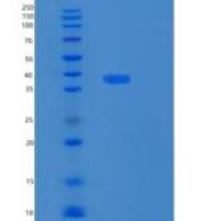 人RPRD1B重组蛋白