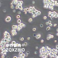 EB-3人淋巴样Burkitt淋巴瘤细胞