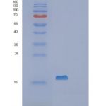 人剪接因子3B亚基14(SF3B14)重组蛋白