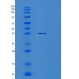 人SDCBP重组蛋白