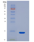 人S100钙结合蛋白B(S100B)重组蛋白